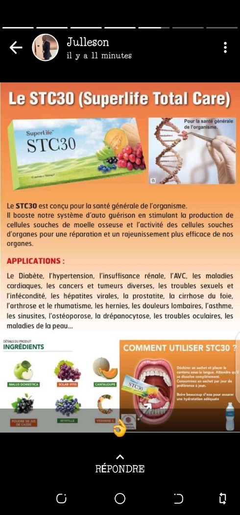 STC30,SIC, SCC+